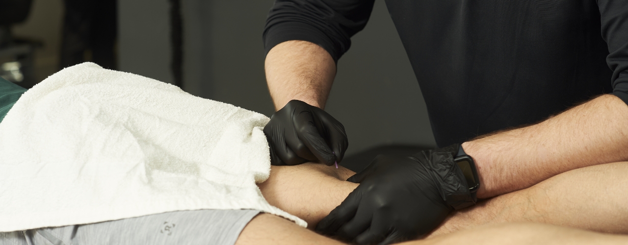 Dry Needling